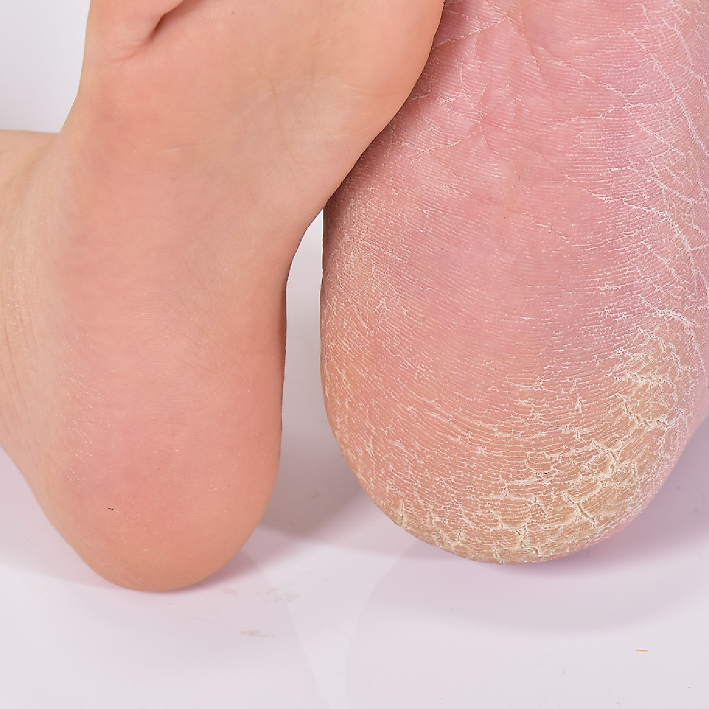 【気になるカサカサ★臭い対策に！】FOOT角質ケアフットパック付き　￥3696