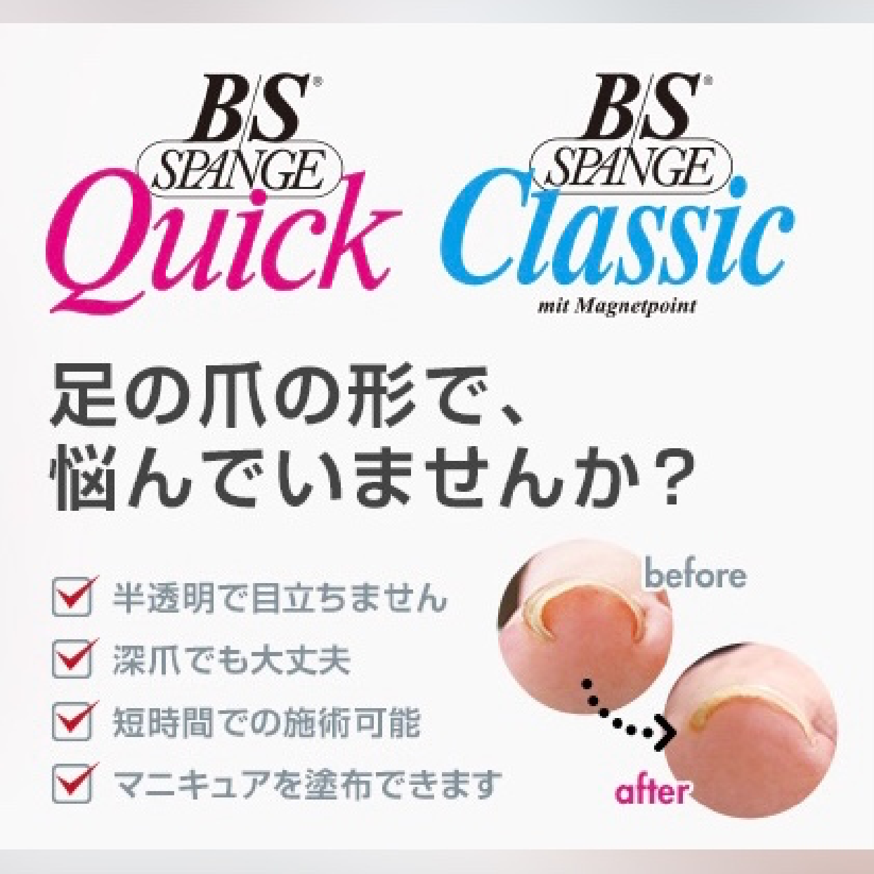 👑B/Sクイック【巻き爪矯正】※施術する爪のみケア付！