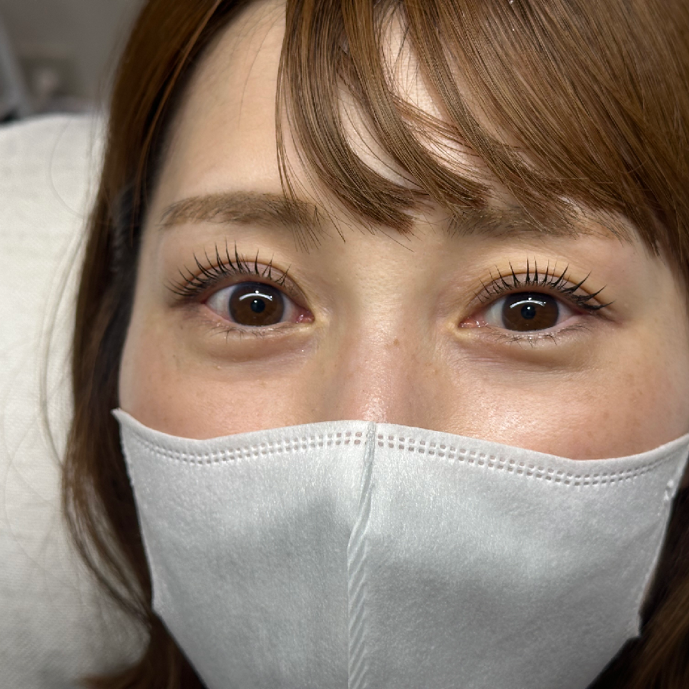 【似合わせラッシュリフト】