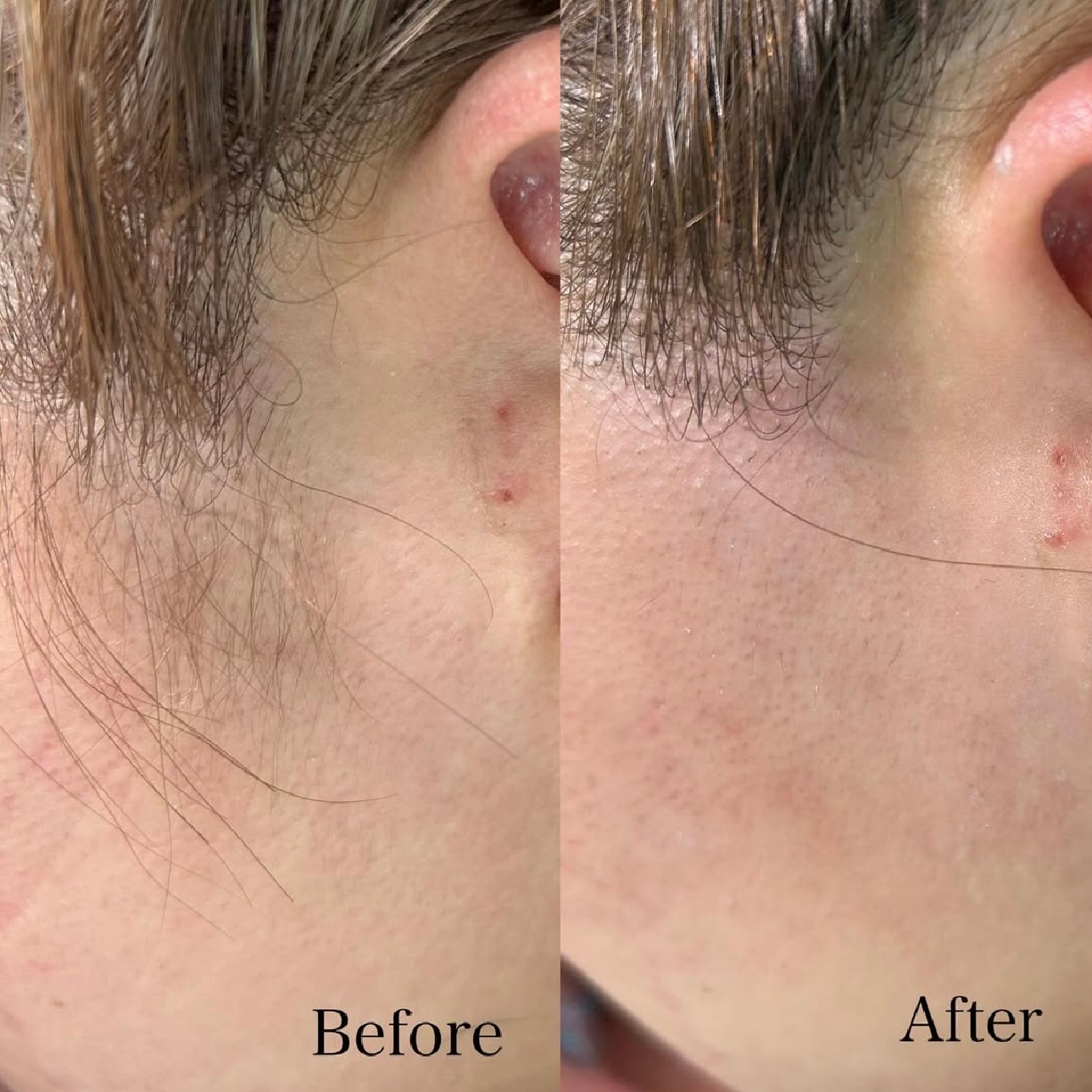 フットネイル×フェイシャルWAX