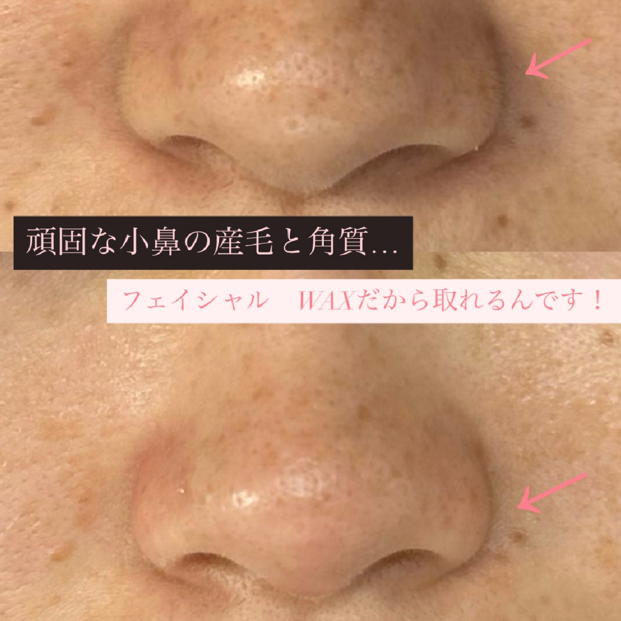 フットネイル＆フェイシャルワックス💝