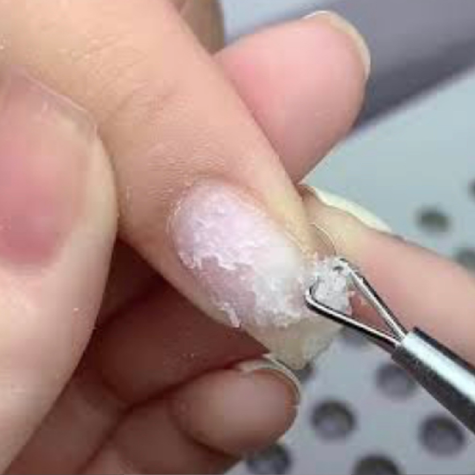 ソフトジェルのオフ ⏰60分