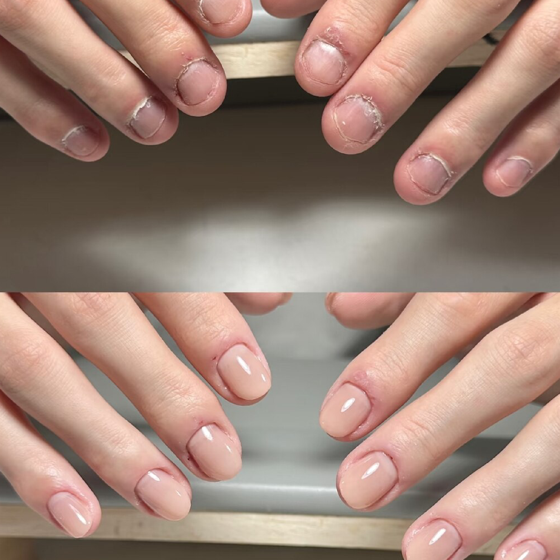 深爪矯正ナチュラルコース　自爪風な仕上がり！