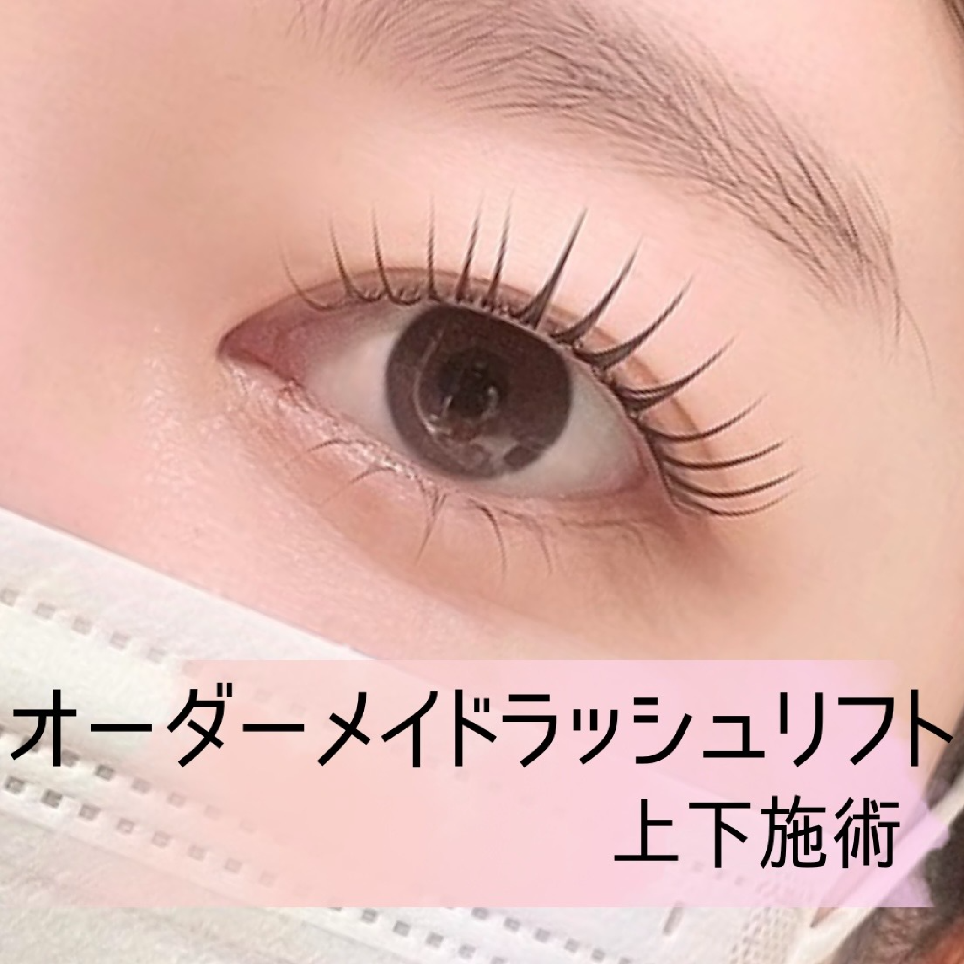 【中顔面短縮♪】オーダーメイドラッシュリフト上下施術　2step ｔｒ付
