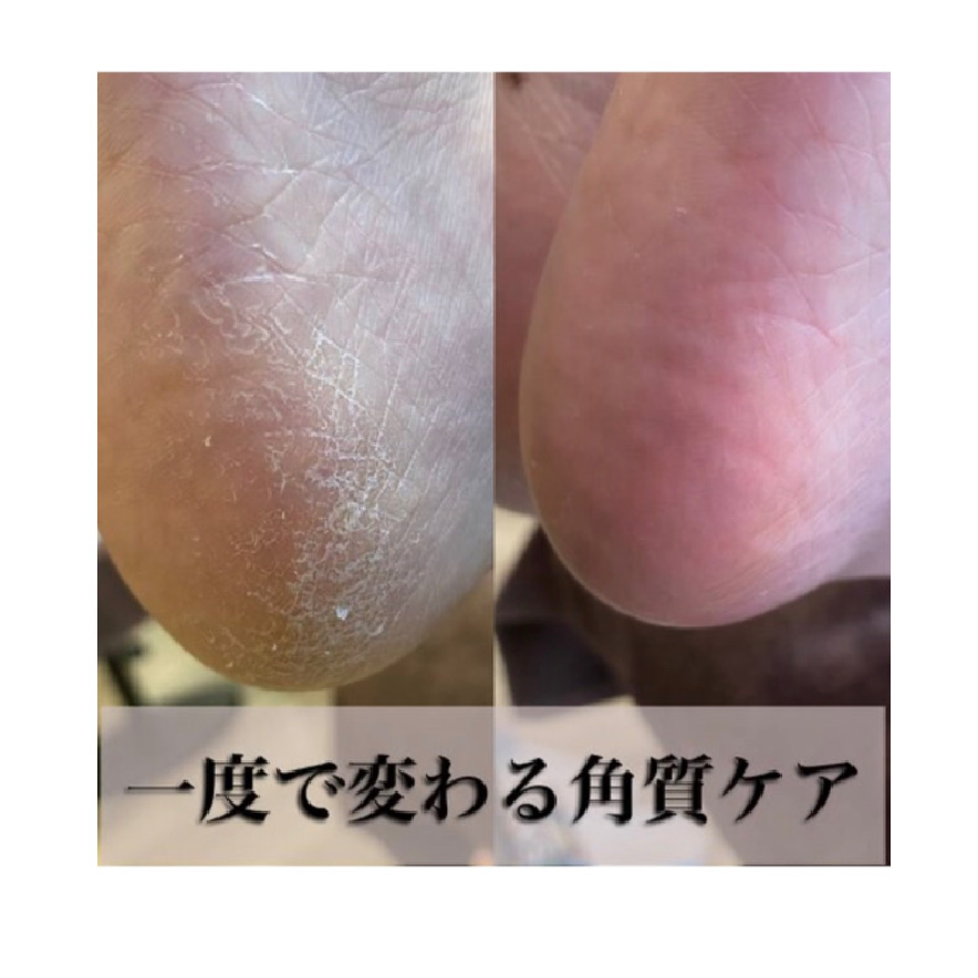 【1度で激変♪最新角質ケア】ハンド・フットネイルどちらかセットでお得◎