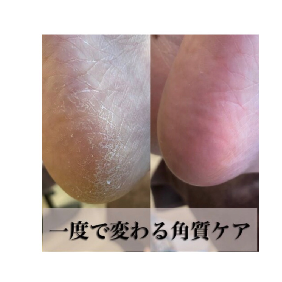 冬にカサカサ必須♪【１度で激変♪最新角質ケア】かかともツルツル★パック付