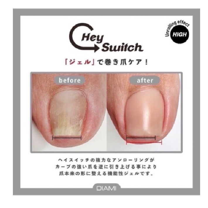 韓国より上陸☆「巻爪ケア」HeySwitch＆角質ケアスペシャルコース¥8400