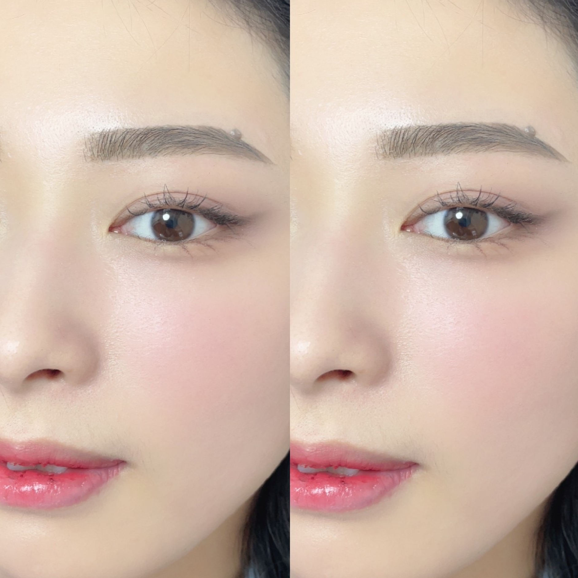美肌WAX脱毛1ヵ所