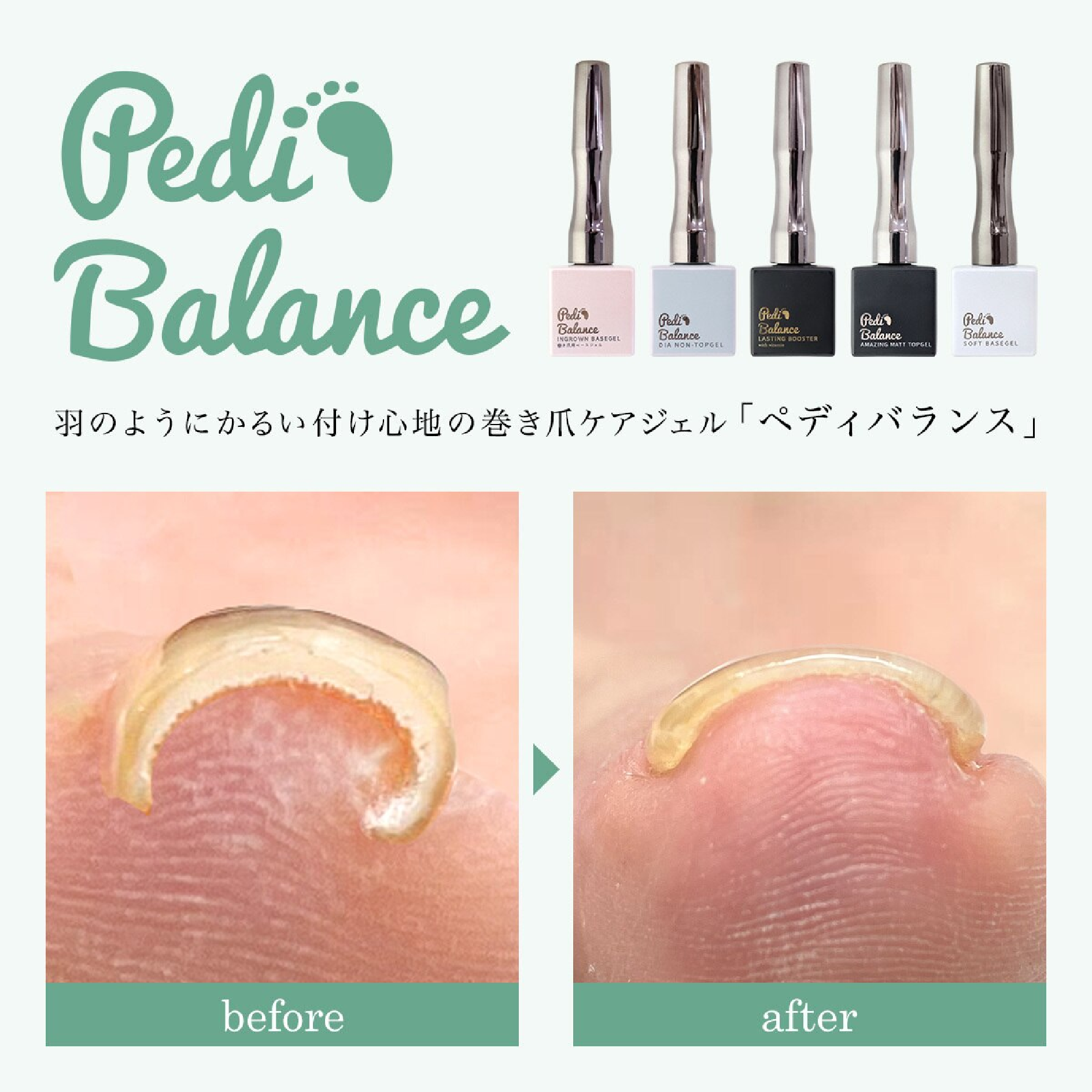 フットワンカラー★巻き爪ケアジェルペディバランス使用（親指のみ）¥11,500