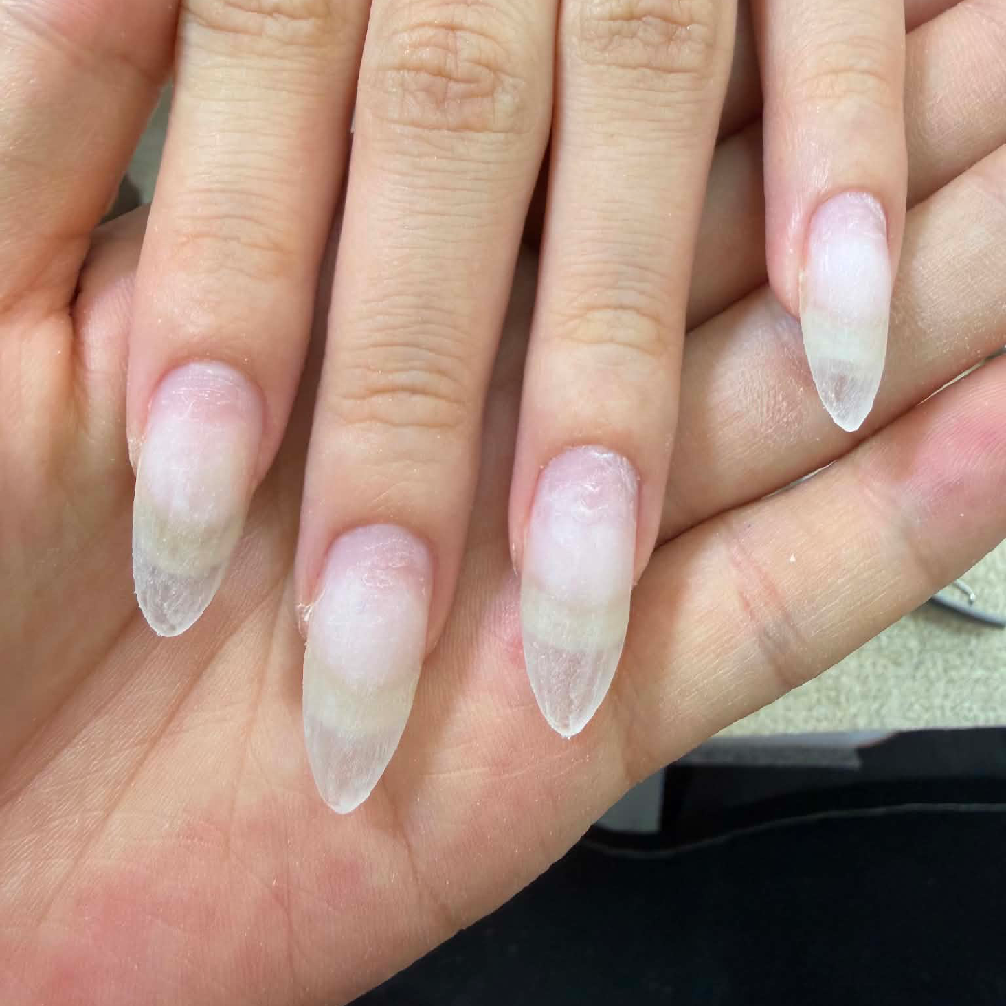 チップ、スカルプオフのみ